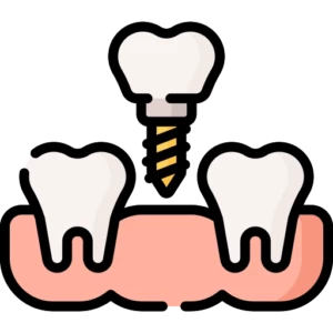 implant (1)